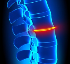 Lumbar disc injury